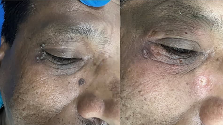 Dermatology treatment 1