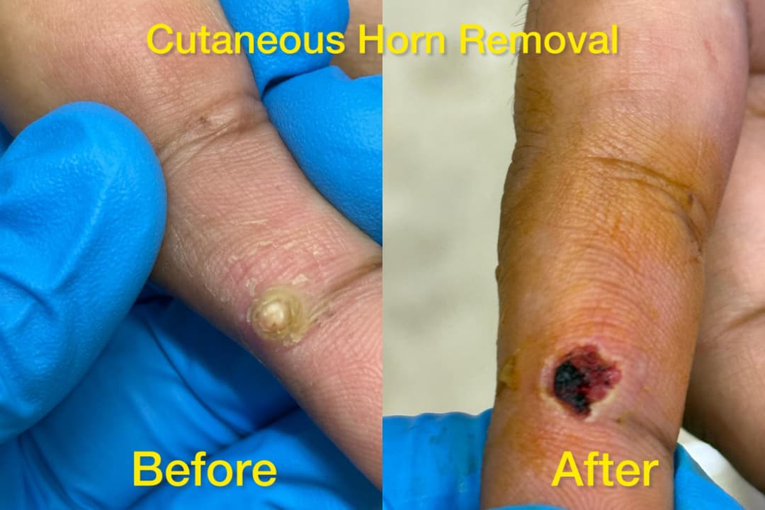 Dermatology treatment 9