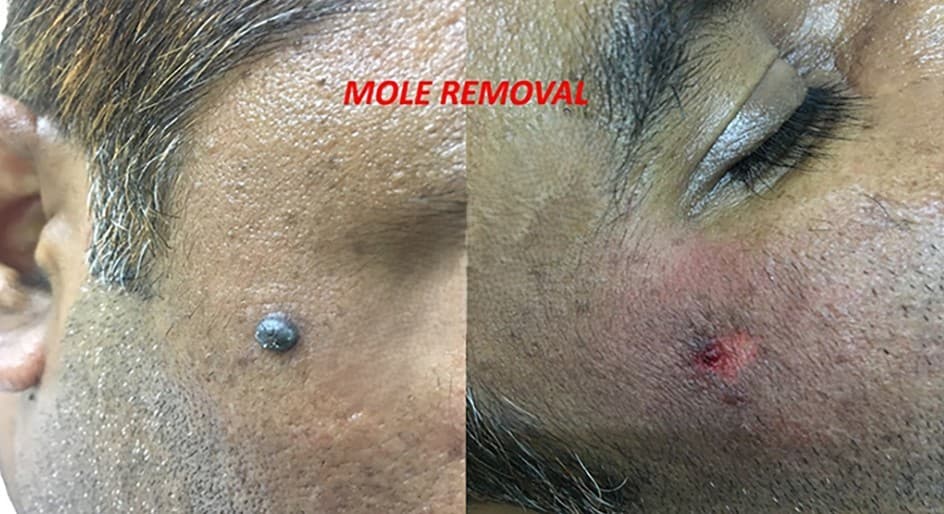 Dermatology treatment 2