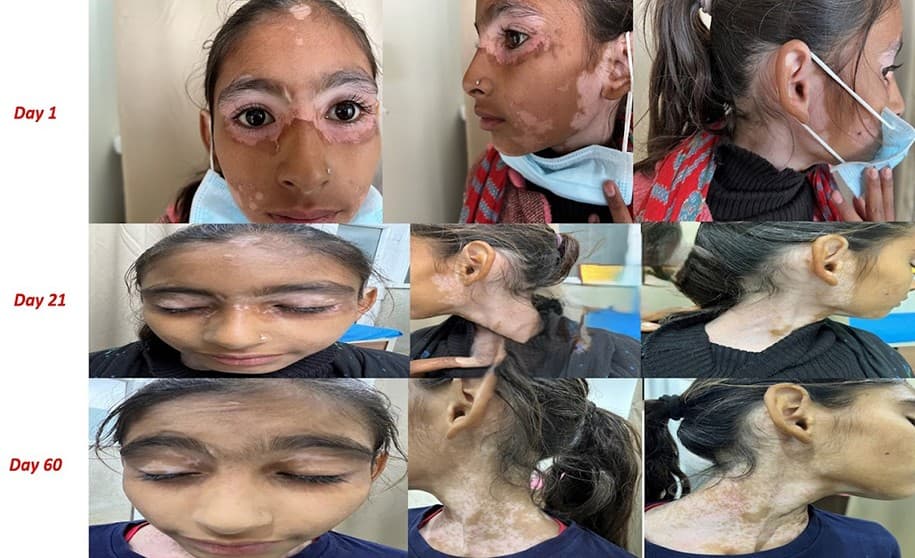 Dermatology treatment 3