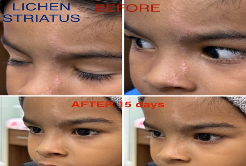 Dermatology treatment 4