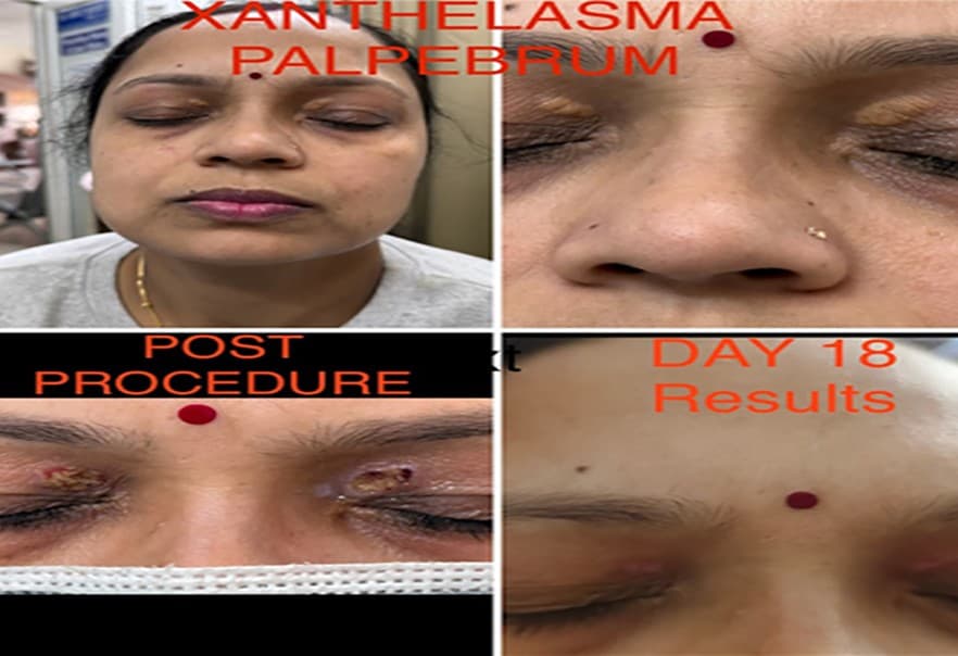 Dermatology treatment 5