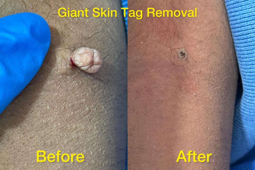 Dermatology treatment 8