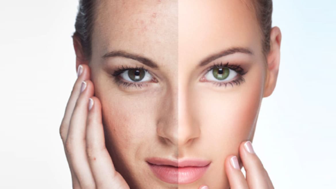 Skin Rejuvenation 2
