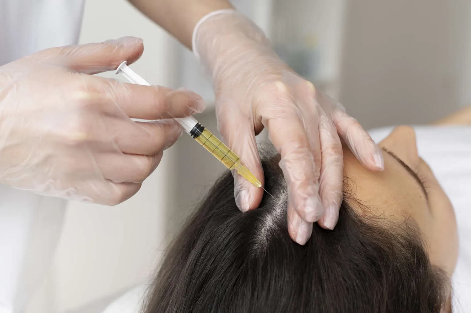 PRP Therapy 1