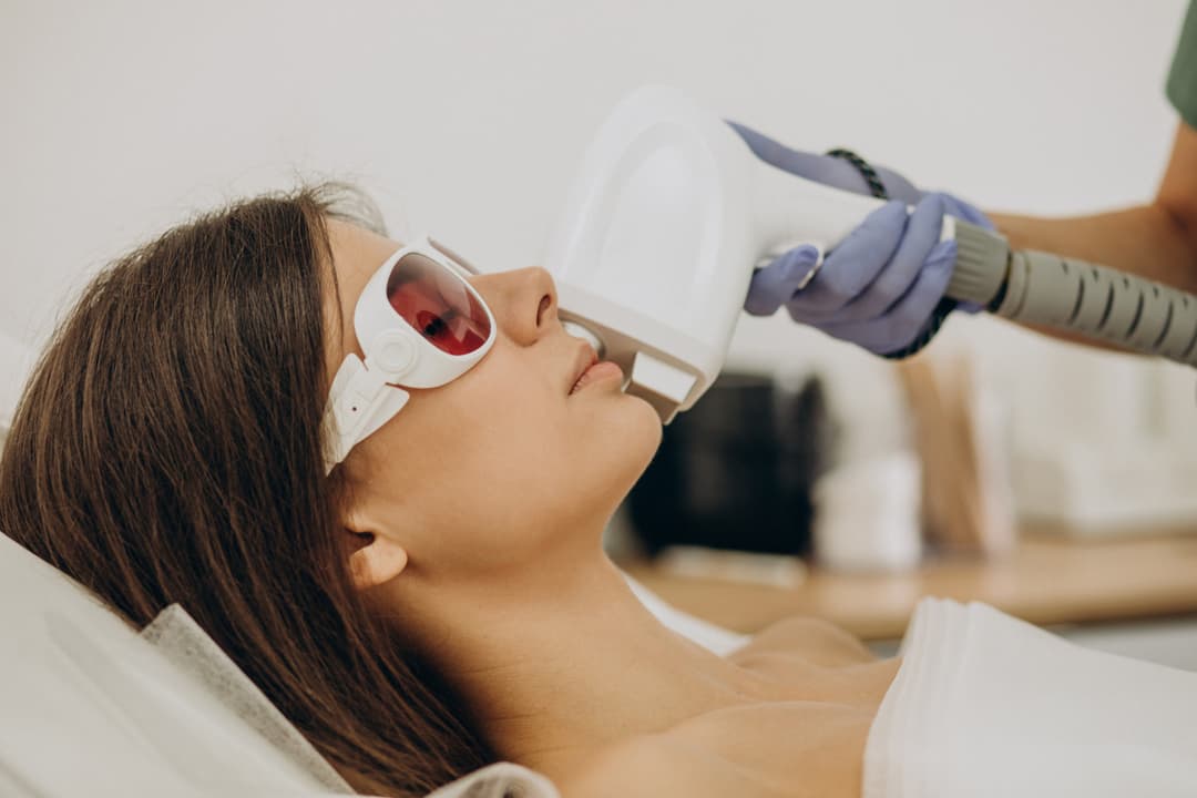 Laser Skin Resurfacing