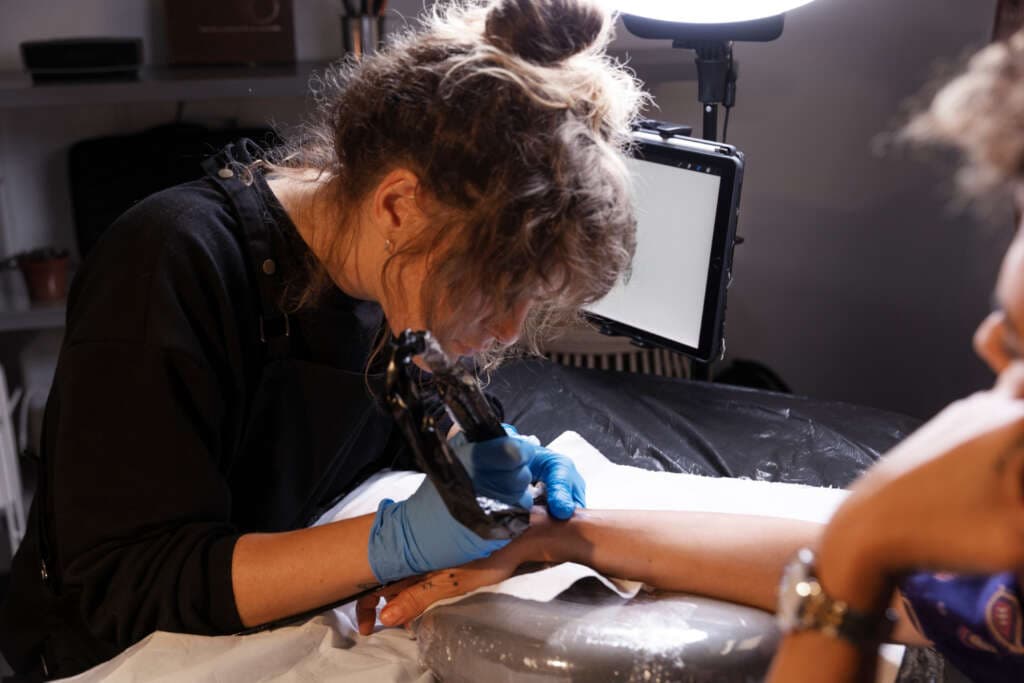 Laser Tattoo Removal