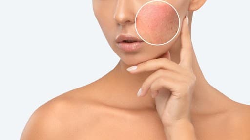 good pigmentation-treatment
